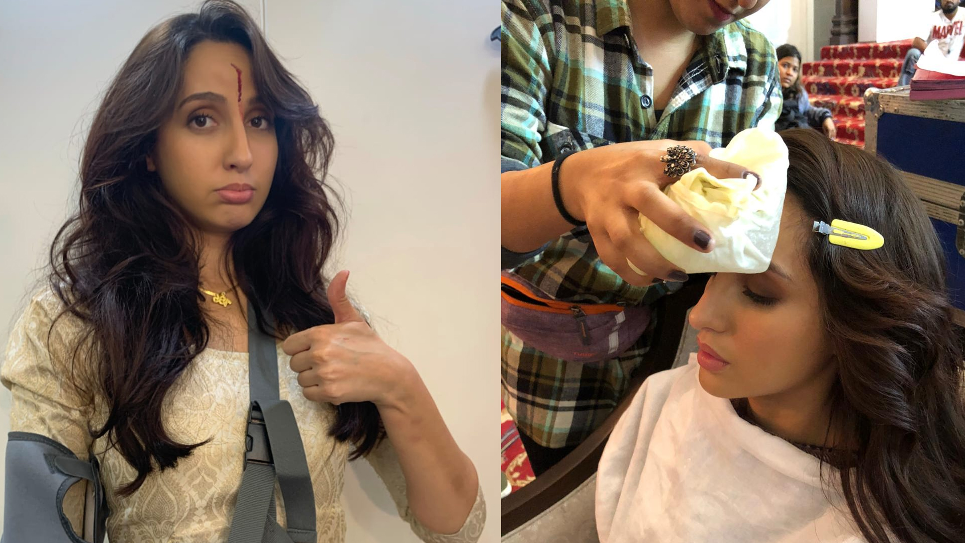 Nora Fatehi sheds real blood for ‘Bhuj: The Pride of India’, scar on face depicts dedication