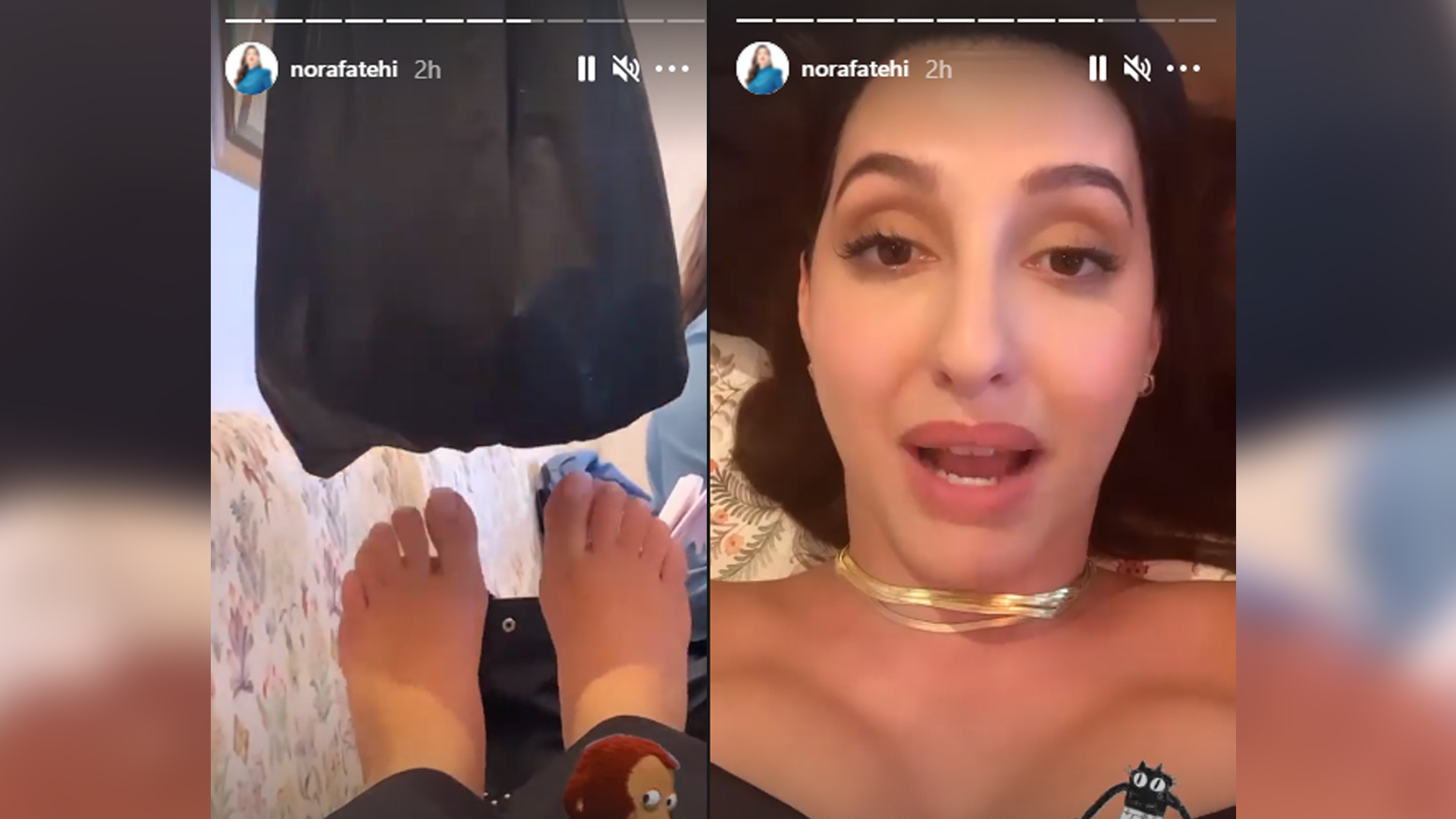 Nora Fatehi shares her painful ordeal, shoots despite swollen feet