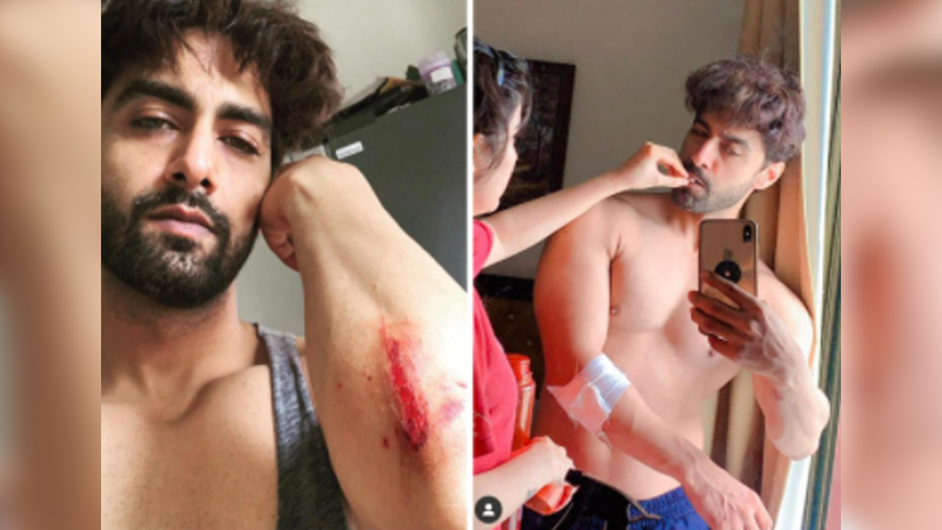 Rohit Purohit got hurt, wife Sheena Bajaj becomes the perfect nurse