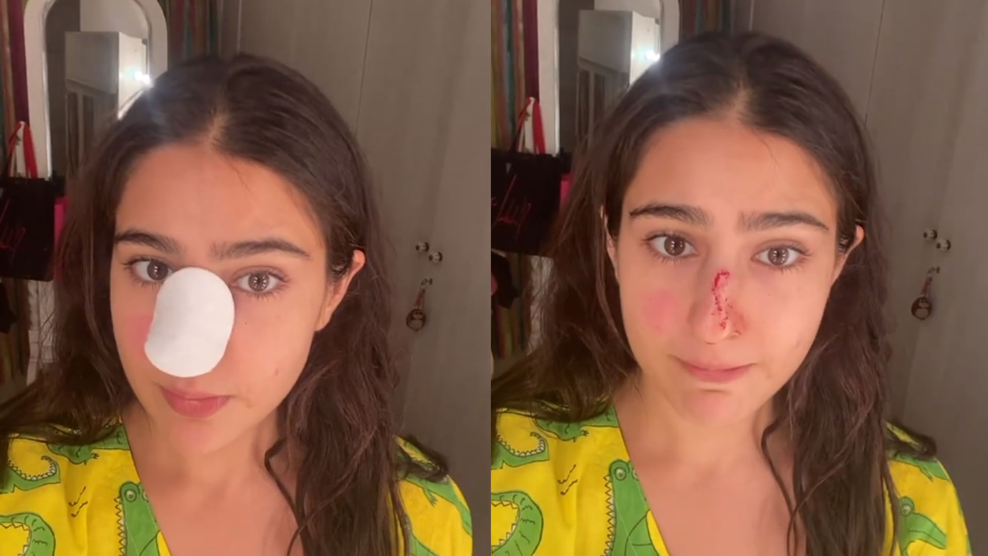 Sara Ali Khan has hilarious knock-knock joke for her nose injury, Check it out!