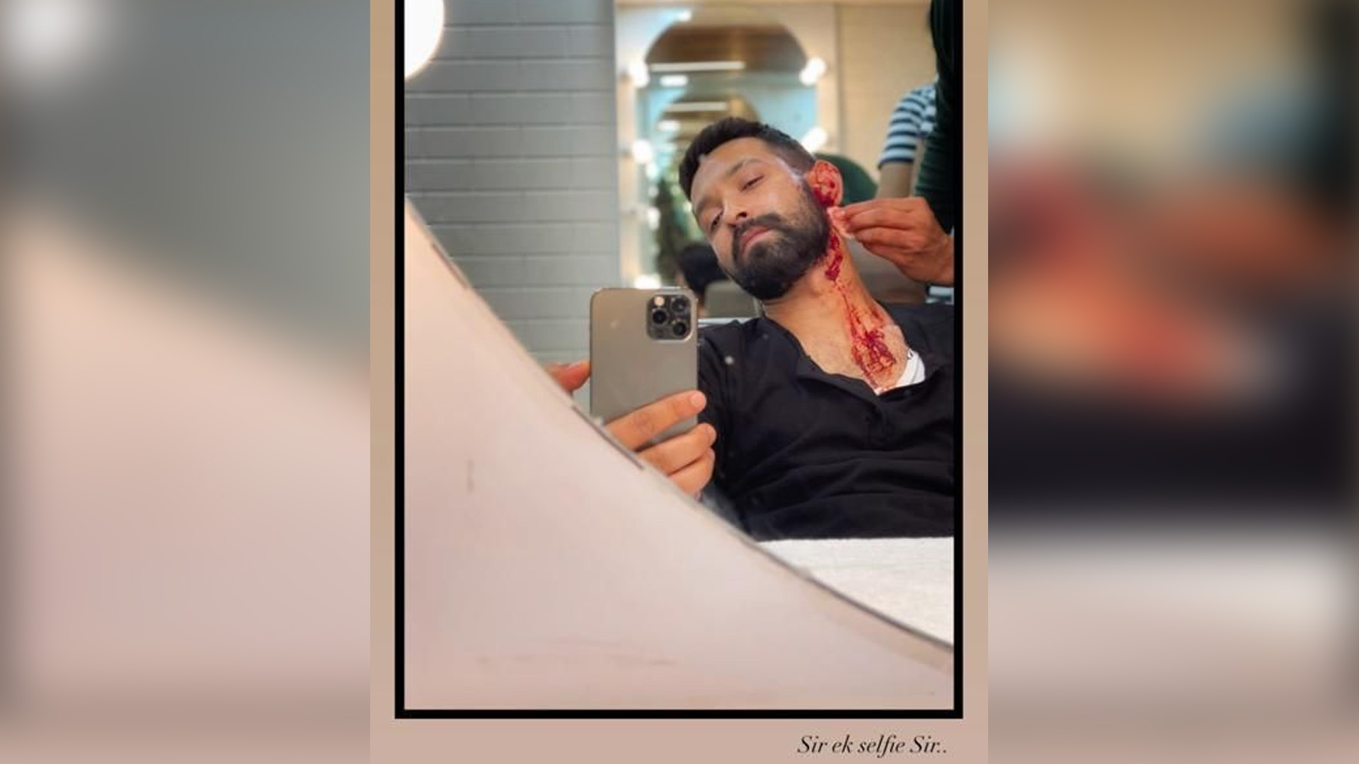 Vikrant Massey builds anticipation with a “bloody” selfie!