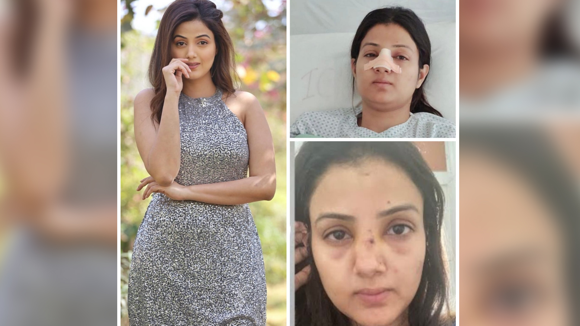 Kismat Ki Lakiro se actress Sumati Singh opens up about an unfortunate accident in the past that led to changing her entire face structure, says, “Every morning I used to hide in a bathroom and cry for 10-15 minutes because my whole face was changed and I looked very weird”